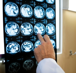 X-ray checking on the screen by doctors